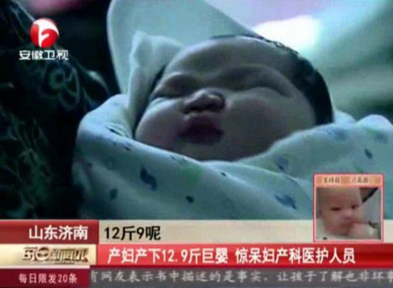 山东产妇产下12.9斤巨婴 盘点世界各国著名巨婴