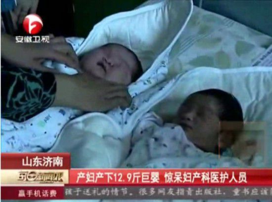 山东产妇产下12.9斤巨婴 盘点世界各国著名巨婴