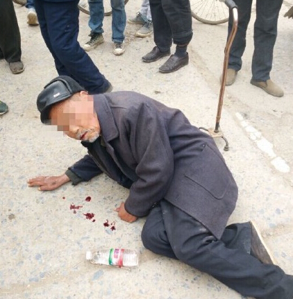 老人吐血行乞真相