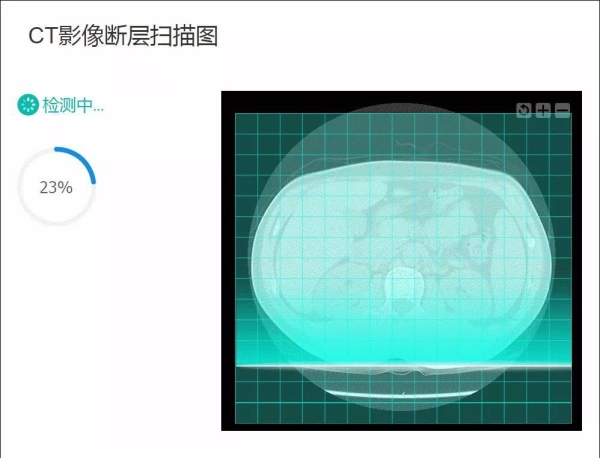 CT影像.jpg