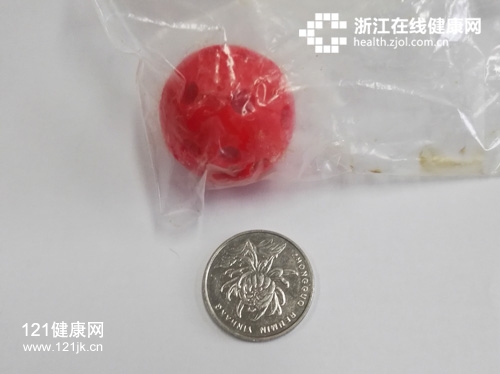 异物.jpg 异物.jpg